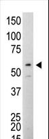 SRC Antibody - The anti-Src antibody is used in Western blot to detect Src in Jurkat cell lysate.