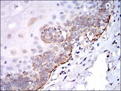 SRC Antibody - IHC of paraffin-embedded esophageal tissues using SRC mouse monoclonal antibody with DAB staining.