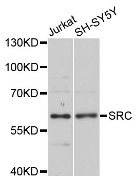 SRC Antibody - Western blot analysis of extracts of various cell lines, using SRC antibody at 1:1000 dilution. The secondary antibody used was an HRP Goat Anti-Rabbit IgG (H+L) at 1:10000 dilution. Lysates were loaded 25ug per lane and 3% nonfat dry milk in TBST was used for blocking. An ECL Kit was used for detection and the exposure time was 5s.