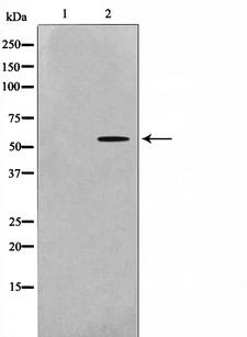SRC Antibody - Western blot analysis of Src expression in 293 whole cells lysates. The lane on the left is treated with the antigen-specific peptide.