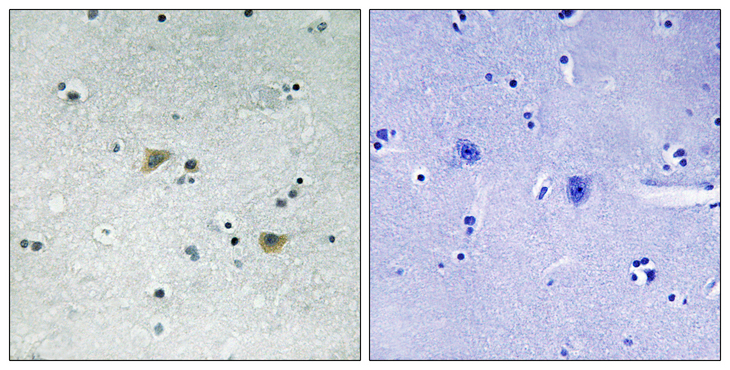 SRC Antibody - Immunohistochemistry analysis of paraffin-embedded human brain, using Src (Phospho-Ser75) Antibody. The picture on the right is blocked with the phospho peptide.