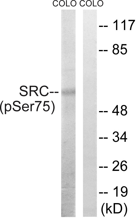 SRC Antibody - Western blot analysis of lysates from COLO205 cells treated with EGF 200ng/ml 30', using Src (Phospho-Ser75) Antibody. The lane on the right is blocked with the phospho peptide.