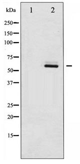 SRC Antibody - Western blot of Src phosphorylation expression in COLO205 whole cell lysates,The lane on the left is treated with the antigen-specific peptide.