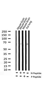 SRC Antibody - Western blot analysis of Phospho-Src (Ser75) expression in various lysates