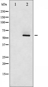 SRC Antibody - Western blot analysis of Src phosphorylation expression in COLO205 whole cells lysates. The lane on the left is treated with the antigen-specific peptide.