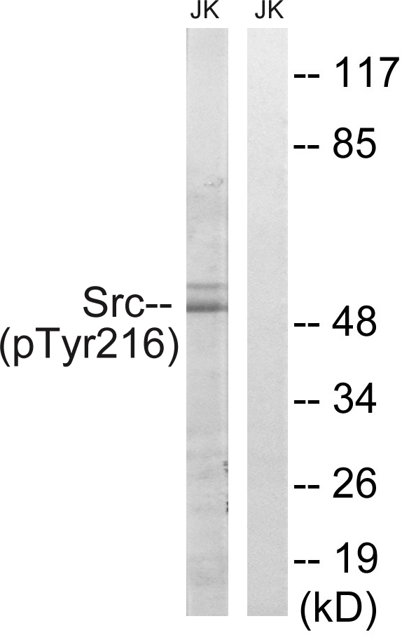 SRC Antibody - Western blot analysis of lysates from Jurkat cells treated with EGF 200ng/ml 5', using Src (Phospho-Tyr216) Antibody. The lane on the right is blocked with the phospho peptide.