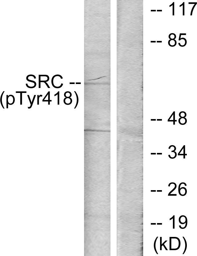 SRC Antibody - Western blot analysis of lysates from COLO205 cells treated with serum 15% 10', using Src (Phospho-Tyr418) Antibody. The lane on the right is blocked with the phospho peptide.