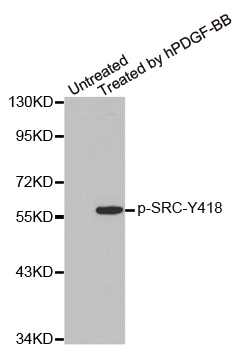 SRC Antibody - Western blot analysis of extracts from COLO205 cells.