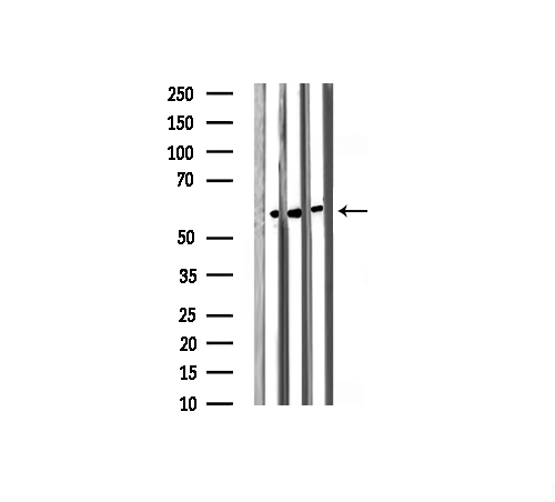 SRC Antibody - Western blot analysis of Phospho-Src (Tyr418) expression in various lysates