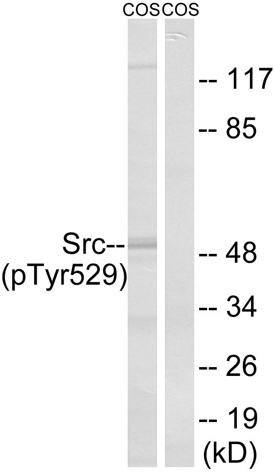 SRC Antibody - Western blot analysis of lysates from COS7 cells treated with PMA 125ng/ml 30', using Src (Phospho-Tyr529) Antibody. The lane on the right is blocked with the phospho peptide.