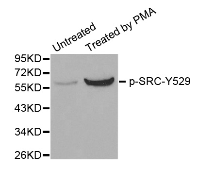 SRC Antibody - Western blot analysis of extracts from HT29 cells.