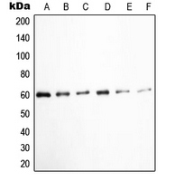 SRC Antibody - Western blot analysis of c-SRC (pY529) expression in K562 (A); HUVEC (B); Jurkat (C); COLO205 (D); HEK293T EGF-treated (E); A431 pervanadate-treated (F) whole cell lysates.