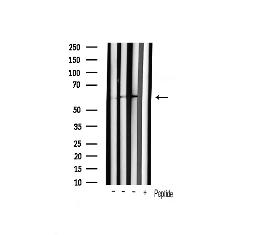 SRC Antibody - Western blot analysis of extracts of various cellslines using Phospho-Src (Tyr529) antibody.