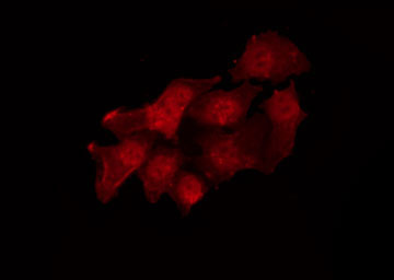 SRC Antibody - Staining 293 cells by IF/ICC. The samples were fixed with PFA and permeabilized in 0.1% Triton X-100, then blocked in 10% serum for 45 min at 25°C. The primary antibody was diluted at 1:200 and incubated with the sample for 1 hour at 37°C. An Alexa Fluor 594 conjugated goat anti-rabbit IgG (H+L) Ab, diluted at 1/600, was used as the secondary antibody.