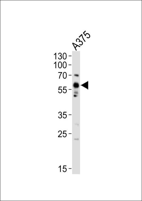 SRC Antibody - Western blot of lysate from A375 cell line, using SRC Antibody (Y419). Antibody was diluted at 1:1000. A goat anti-rabbit IgG H&L (HRP) at 1:10000 dilution was used as the secondary antibody. Lysate at 20ug.