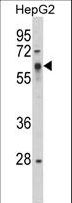 SRC Antibody - Western blot of Phospho-SRC-Y419 in HepG2 cell line lysates (35 ug/lane). SRC (arrow) was detected using the purified antibody.