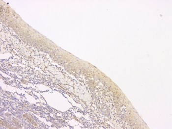 SRCIN1 / SNIP Antibody - IHC staining of FFPE human tonsil with SRCIN1 antibody at 1ug/ml. HIER: boil tissue sections in pH6, 10mM citrate buffer, for 10-20 min and allow to cool before testing.