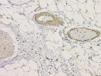 SRCIN1 / SNIP Antibody - IHC staining of FFPE human appendicitis tissue with SRCIN1 antibody at 1ug/ml. HIER: boil tissue sections in pH6, 10mM citrate buffer, for 10-20 min and allow to cool before testing.