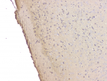 SRCIN1 / SNIP Antibody - IHC staining of FFPE mouse brain with SRCIN1 antibody at 1ug/ml. HIER: boil tissue sections in pH6, 10mM citrate buffer, for 10-20 min and allow to cool before testing.