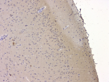 SRCIN1 / SNIP Antibody - IHC staining of FFPE rat brain with SRCIN1 antibody at 1ug/ml. HIER: boil tissue sections in pH6, 10mM citrate buffer, for 10-20 min and allow to cool before testing.