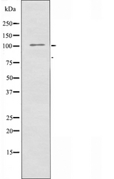 SRCIN1 / SNIP Antibody - Western blot analysis of extracts of HepG2 cells using SNIP antibody.