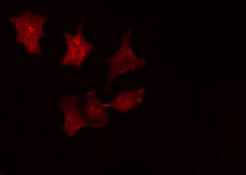 SRCIN1 / SNIP Antibody - Staining HepG2 cells by IF/ICC. The samples were fixed with PFA and permeabilized in 0.1% Triton X-100, then blocked in 10% serum for 45 min at 25°C. The primary antibody was diluted at 1:200 and incubated with the sample for 1 hour at 37°C. An Alexa Fluor 594 conjugated goat anti-rabbit IgG (H+L) antibody, diluted at 1/600, was used as secondary antibody.