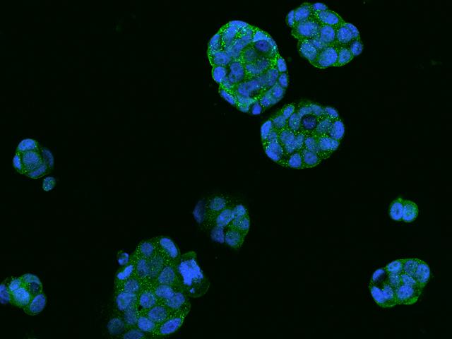 SRCIN1 / SNIP Antibody - Immunofluorescence staining of SRCIN1 in MCF7 cells. Cells were fixed with 4% PFA, permeabilzed with 0.1% Triton X-100 in PBS, blocked with 10% serum, and incubated with rabbit anti-Human SRCIN1 polyclonal antibody (dilution ratio 1:200) at 4°C overnight. Then cells were stained with the Alexa Fluor 488-conjugated Goat Anti-rabbit IgG secondary antibody (green) and counterstained with DAPI (blue). Positive staining was localized to Cytoplasm.