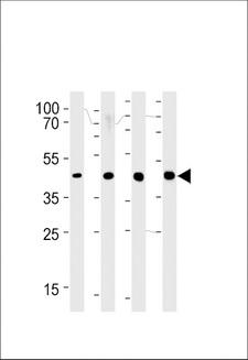 SRD5A2L / SRD5A3 Antibody - SRD5A3 Antibody western blot of 293,LNCaP,PC-3,NCI-H292 cell line lysates (35 ug/lane). The SRD5A3 antibody detected the SRD5A3 protein (arrow).