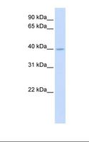 SRD5A2L / SRD5A3 Antibody - Fetal muscle lysate. Antibody concentration: 1.0 ug/ml. Gel concentration: 12%.  This image was taken for the unconjugated form of this product. Other forms have not been tested.