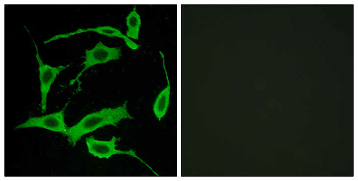 SREB / GPR85 Antibody - Immunofluorescence analysis of LOVO cells, using GPR85 Antibody. The picture on the right is blocked with the synthesized peptide.