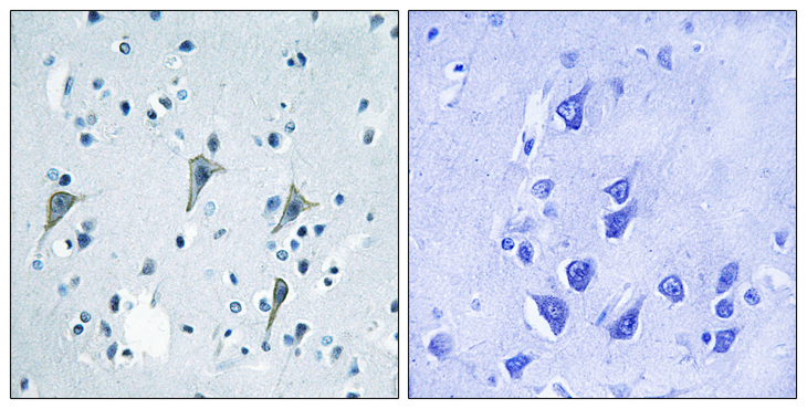SREB / GPR85 Antibody - Immunohistochemistry analysis of paraffin-embedded human brain tissue, using GPR85 Antibody. The picture on the right is blocked with the synthesized peptide.