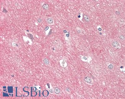 SREB / GPR85 Antibody - Human Brain, Cortex: Formalin-Fixed, Paraffin-Embedded (FFPE).  This image was taken for the unconjugated form of this product. Other forms have not been tested.