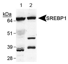 SREBF1 / SREBP-1 Antibody - Detection of SREBP1. Lane 1: human liver, Lane 2: mouse liver.  This image was taken for the unconjugated form of this product. Other forms have not been tested.