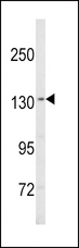 SREBF1 / SREBP-1 Antibody - Western blot of SREBF1 Antibody in MDA-MB435 cell line lysates (35 ug/lane). SREBF1 (arrow) was detected using the purified antibody.