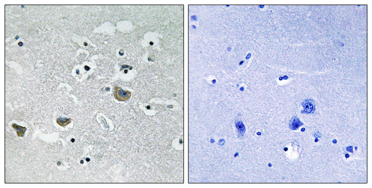 SREBF1 / SREBP-1 Antibody - Immunohistochemistry analysis of paraffin-embedded human brain tissue, using SREBP-1 Antibody. The picture on the right is blocked with the synthesized peptide.