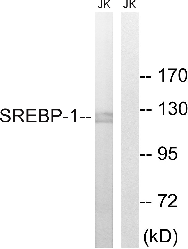 SREBF1 / SREBP-1 Antibody - Western blot analysis of lysates from Jurkat cells, treated with TNF 20ng/ml 30', using SREBP-1 Antibody. The lane on the right is blocked with the synthesized peptide.