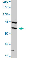 SREBF1 / SREBP-1 Antibody - SREBF1 monoclonal antibody (M01), clone 4B10. Western Blot analysis of SREBF1 expression in HeLa.
