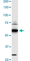 SREBF1 / SREBP-1 Antibody - SREBF1 monoclonal antibody (M01), clone 4B10 Western Blot analysis of SREBF1 expression in HepG2.