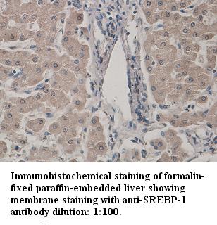 SREBF1 / SREBP-1 Antibody