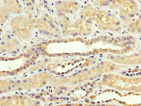 SREBF1 / SREBP-1 Antibody - Immunohistochemistry image at a dilution of 1:300 and staining in paraffin-embedded human kidney tissue performed on a Leica BondTM system. After dewaxing and hydration, antigen retrieval was mediated by high pressure in a citrate buffer (pH 6.0) . Section was blocked with 10% normal goat serum 30min at RT. Then primary antibody (1% BSA) was incubated at 4 °C overnight. The primary is detected by a biotinylated secondary antibody and visualized using an HRP conjugated SP system.