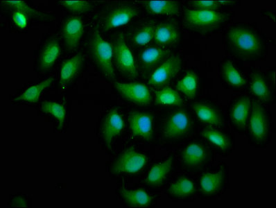 SREBF1 / SREBP-1 Antibody - Immunofluorescence staining of A549 cells with SREBF1 Antibody at 1:100, counter-stained with DAPI. The cells were fixed in 4% formaldehyde, permeabilized using 0.2% Triton X-100 and blocked in 10% normal Goat Serum. The cells were then incubated with the antibody overnight at 4°C. The secondary antibody was Alexa Fluor 488-congugated AffiniPure Goat Anti-Rabbit IgG(H+L).