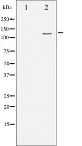 SREBF1 / SREBP-1 Antibody - Western blot analysis of SREBP-1 expression in TNF treated JK whole cells lysates. The lane on the left is treated with the antigen-specific peptide.