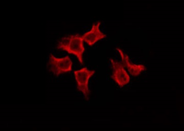 SREBF1 / SREBP-1 Antibody - Staining HeLa cells by IF/ICC. The samples were fixed with PFA and permeabilized in 0.1% Triton X-100, then blocked in 10% serum for 45 min at 25°C. The primary antibody was diluted at 1:200 and incubated with the sample for 1 hour at 37°C. An Alexa Fluor 594 conjugated goat anti-rabbit IgG (H+L) Ab, diluted at 1/600, was used as the secondary antibody.