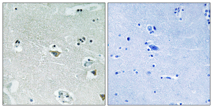 SREBF1 / SREBP-1 Antibody - Immunohistochemistry analysis of paraffin-embedded human brain, using SREBP-1 (Phospho-Ser439) Antibody. The picture on the right is blocked with the phospho peptide.