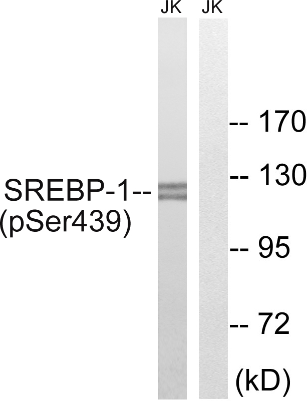 SREBF1 / SREBP-1 Antibody - Western blot analysis of lysates from Jurkat cells treated with TNF 20ng/ml 30', using SREBP-1 (Phospho-Ser439) Antibody. The lane on the right is blocked with the phospho peptide.