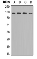 SREBF1 / SREBP-1 Antibody - Western blot analysis of SREBP1 (pS439) expression in MCF7 (A); PC3 (B); HeLa (C); NIH3T3 (D) whole cell lysates.