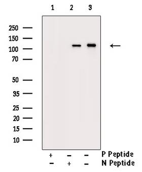 SREBF1 / SREBP-1 Antibody - 1/100 staining human brain tissue by IHC-P. The sample was formaldehyde fixed and a heat mediated antigen retrieval step in citrate buffer was performed. The sample was then blocked and incubated with the antibody for 1.5 hours at 22°C. An HRP conjugated goat anti-rabbit antibody was used as the secondary antibody.