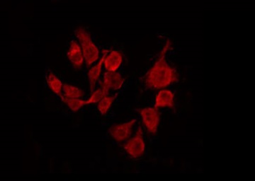 SREBF1 / SREBP-1 Antibody - Staining HeLa cells by IF/ICC. The samples were fixed with PFA and permeabilized in 0.1% Triton X-100, then blocked in 10% serum for 45 min at 25°C. The primary antibody was diluted at 1:200 and incubated with the sample for 1 hour at 37°C. An Alexa Fluor 594 conjugated goat anti-rabbit IgG (H+L) Ab, diluted at 1/600, was used as the secondary antibody.
