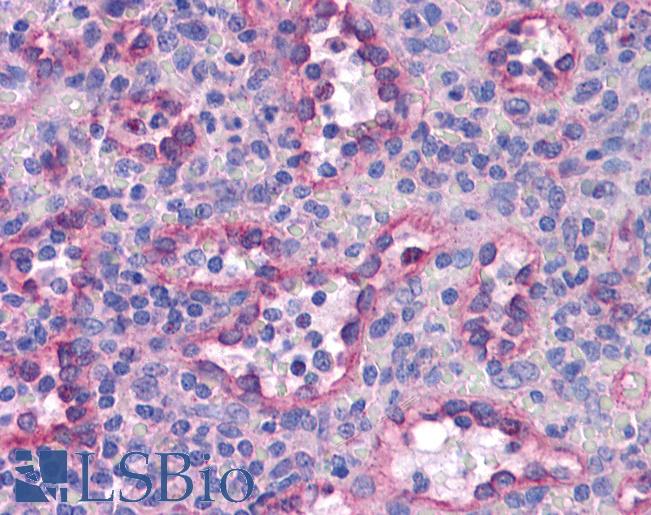 SREBF2 / SREBP2 Antibody - Anti-SREBP-2 antibody IHC of human spleen. Immunohistochemistry of formalin-fixed, paraffin-embedded tissue after heat-induced antigen retrieval. Antibody concentration 5 ug/ml.  This image was taken for the unconjugated form of this product. Other forms have not been tested.