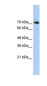 SREBF2 / SREBP2 Antibody - SREBF2 / SREBP-2 antibody Western blot of Transfected 293T cell lysate. This image was taken for the unconjugated form of this product. Other forms have not been tested.